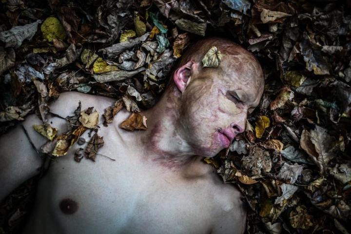 Павел сфотографировал 16-летнего москвича, пострадавшего в результате несчастного случая